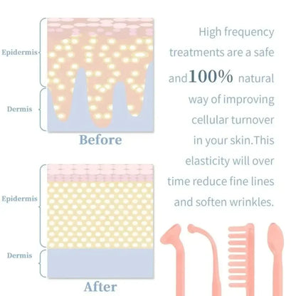 4in1 Facial Beauty Machine High Frequency Electrotherapy Wand Neon Argon Wands Remove wrinkles Rejuvenation Tightening Skin Care