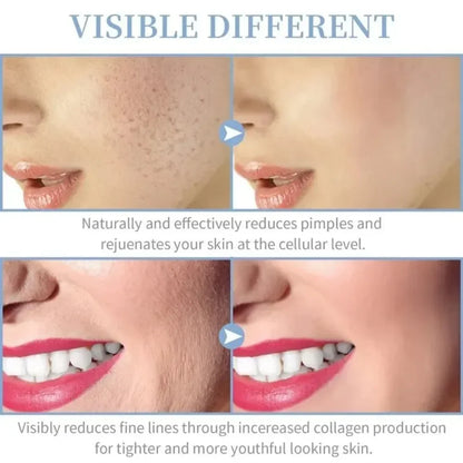 4in1 Facial Beauty Machine High Frequency Electrotherapy Wand Neon Argon Wands Remove wrinkles Rejuvenation Tightening Skin Care