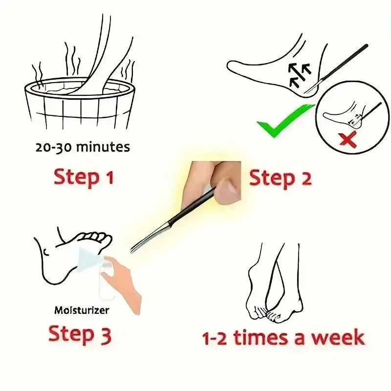Stainless Steel Foot Knife - Dead Skin Remover, Toe Nail Shaver, And Callus Rasp For Pedicure And Foot Care for Shops