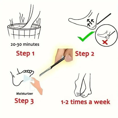 Stainless Steel Foot Knife - Dead Skin Remover, Toe Nail Shaver, And Callus Rasp For Pedicure And Foot Care for Shops